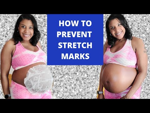 How to Prevent Stretch Marks during Pregnancy | Pregnant Belly Skincare Routine