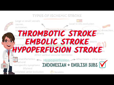 Three types of ischemic stroke | Neuroaholics