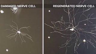 Breakthrough research shows hope for reversing damage in neurological disease