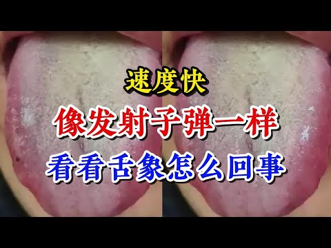 速度快 像发射子弹一样 看看舌象怎么回事