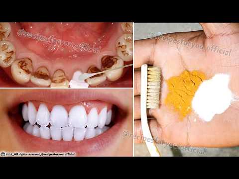 4 Secrets that Dentists don't want you to know  Remove Tartar and Teeth Whitening in just 2 minutes