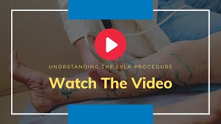 Say Goodbye to Varicose Veins: EVLT Minimally Invasive Surgery Explained