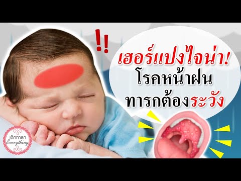 อาการทารก : "เฮอร์แปงใจน่า" โรคหน้าฝนที่ทารกต้องระวัง! | โรคทารก | เด็กทารก Everything