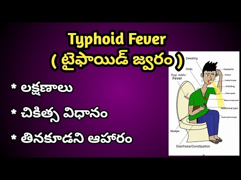 Typhoid Fever Symptoms and Treatment in Telugu ( టైఫాయిడ్ జ్వరం లక్షణాలు,చికిత్స విధానం )