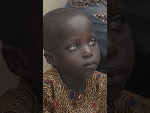 African child with Grey eyes