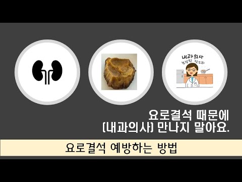 요로결석 (3) 요로 결석으로 내과 의사 만나지 마세요 : 요로 결석 예방하는 방법