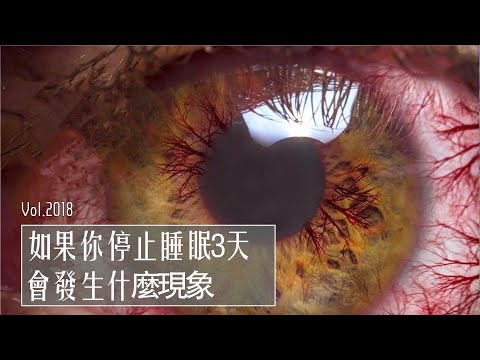 如果你停止睡眠三天，会发什么现象？