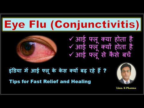 The Shocking Truth of Eye flu || Conjunctivitis || Allergic and Bacterial Conjunctivitis