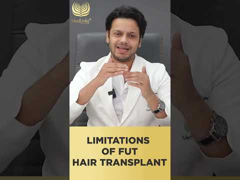 Limitations of FUT Hair Transplant | Medlinks #shortsfeed