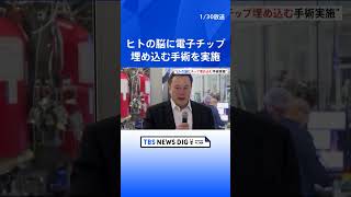 ヒト対象の脳インプラントを初実施…イーロン・マスク氏設立の「ニューラリンク」｜TBS NEWS DIG #shorts