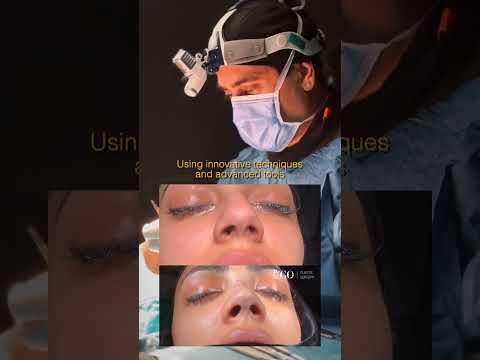 Behind the Scenes: A Day in Rhinoplasty Surgery (Before & After) with Assoc. Prof. Dr. Güncel Öztürk