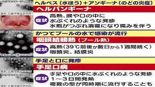 子供の夏の感染症が急増中…専門家に聞いた「3大夏かぜ」の症状と対策は