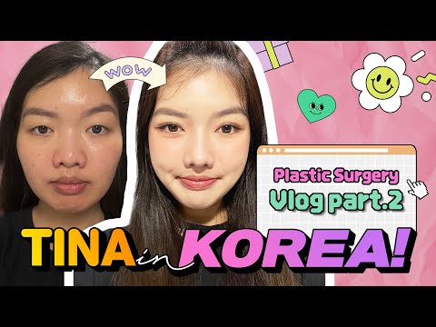 My plastic surgery story (PART2) | Facial contour, rhinoplasty, double eyelid surgery, facial lipo