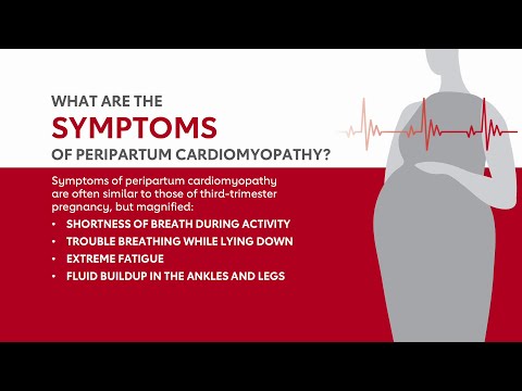 Peripartum Cardiomyopathy Animation