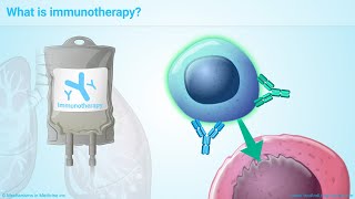 Understanding Immunotherapy for Lung Cancer