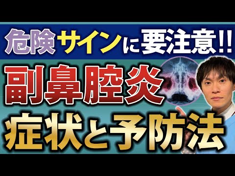 【危険】あなたの風邪が致命的に!? 隠れ副鼻腔炎が引き起こす衝撃の症状10選