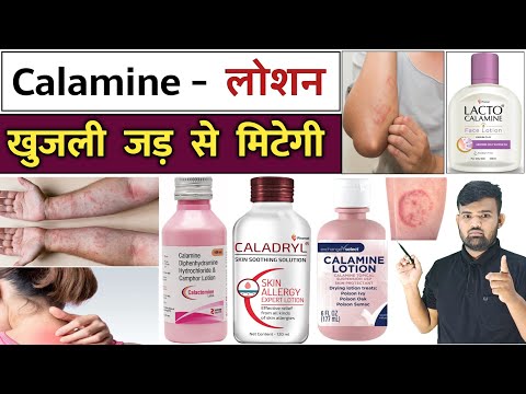 खुजली का इलाज | Calamine Lotion | Antifungal Cream | Treatment | Medicine | Pharmacy | Infection