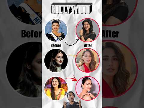 Before 🤡 & After 🔥 || Plastic Surgery In Bollywood 3 || #Shorts