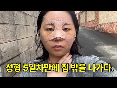 코 수술 이렇게 숨막혀도 되나요😱 이때 진짜 놀랐어요 ㅋㅋㅋ(사실 안 웃김)[유주2Vlog]