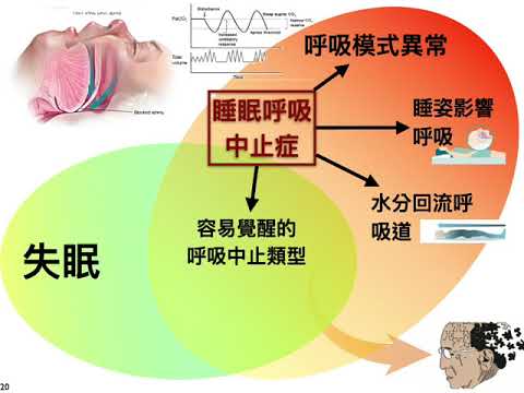 20210519 結合人工智慧發展精準睡眠醫學 居家診斷