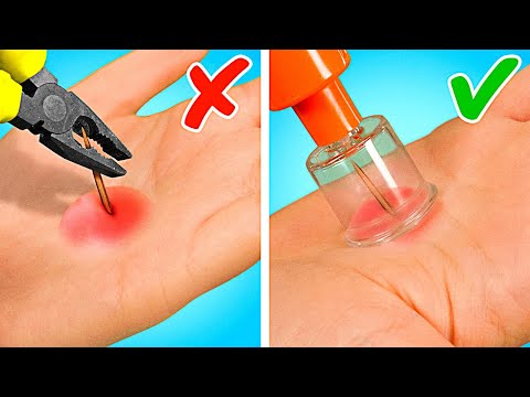 Rich Mom vs Broke Mom || Amazing Hacks Vs Cool Gadgets! Funny Situations by Rocketmons!