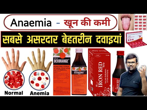 Anaemia - खून की कमी | Treatment | Medicine | Pharmacy | Doctor | Medical | Nursing | MBBS | BHMS