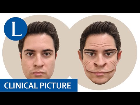 Visualising facial distortions in prosopometamorphopsia