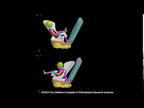 Simulation of a 18-month-old Child in a Rear-facing Versus Forward-facing Child Safety Seat