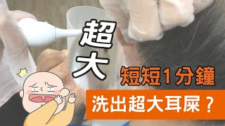 【診所洗耳患者】短短1分鐘竟然清洗出"魔王級"耳屎，驚訝到護士措手不及