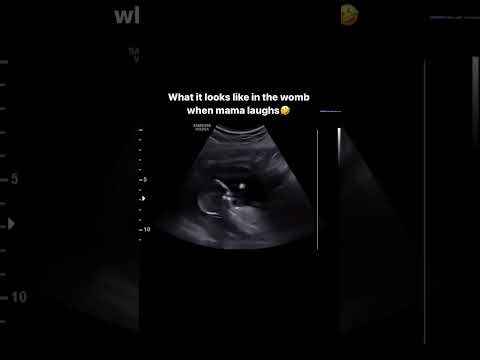 What it looks like in the Womb when mommy laugh #babyultrasound #ultrasound