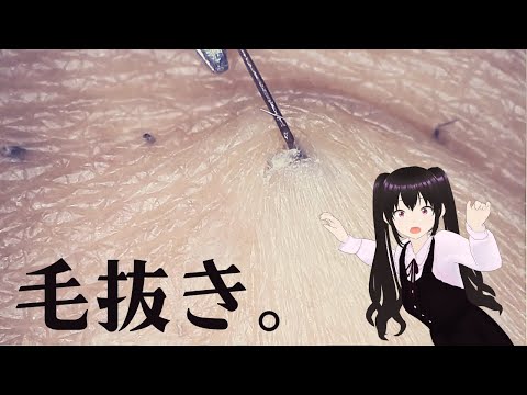 【毛抜き】【埋没毛】毛抜きシーンをひたすら集めた動画【hair remove】