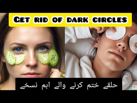 Ankhon k gird halqey |Dark Circle| Dark circles Tips |Dark Circles #darkcircles #eyes