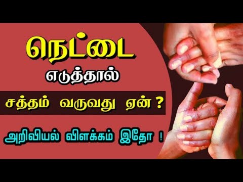 நெட்டை எடுத்தால் சத்தம் வருவது ஏன் ? சொடக்கு போடுவது | cracking knuckles sound | nettai eduthal