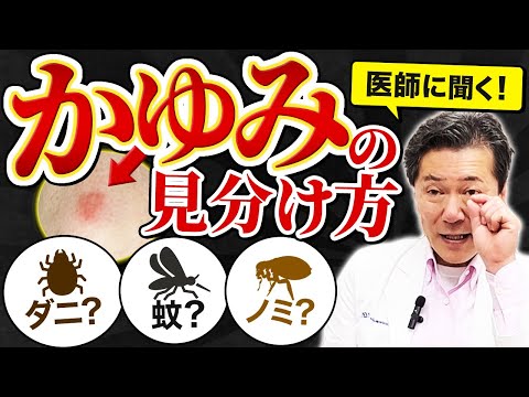 これは虫刺され？ダニ？蚊？蕁麻疹？医師が見分け方について伝授します！#虫刺され #ダニ #蕁麻疹