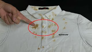 Easy stain removal tricks （簡單的污漬去除技巧 Iinstantly whiten clothes（立即讓衣服變白）