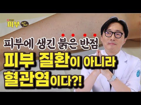 피부에 붉은 반점이 생기는 자반증, ‘이렇게’ 관리하셔야 합니다 - 박치영의 피부 톡톡 #142