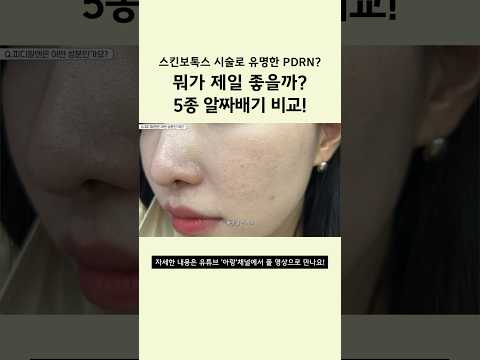 스킨보톡스로 유명하다고? 써보고 추천하는 피디알엔 추천템 #skincare ㅣ아랑