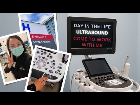 A *very busy* day in the life of a hospital sonographer aka ultrasound technologist in 2024