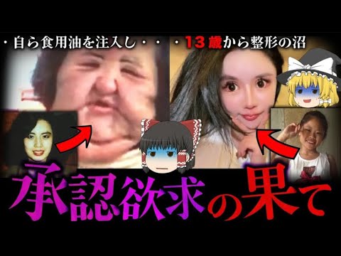 【ゆっくり解説】整形手術の大失敗７選！承認欲求の成れの果て・・・