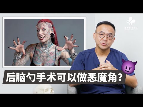 后脑勺填充手术的10个快问快答｜谢明吉医师