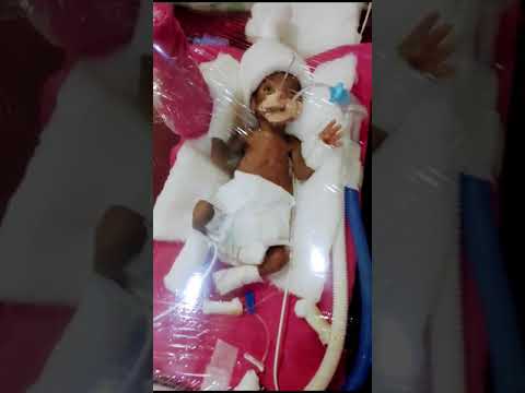 #manakimushkilhaisafar #premature_baby #baby #shorts