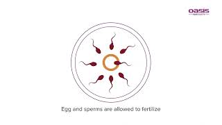 In Vitro Maturation (IVM) || Oasis Fertility