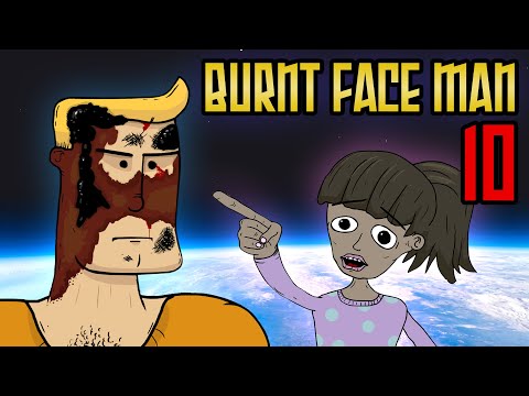 Burnt Face Man Episode 10