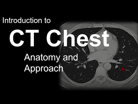 Introduction to CT Chest - Anatomy and Approach