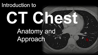 Introduction to CT Chest - Anatomy and Approach