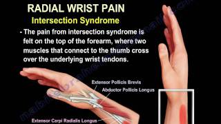 Wrist Pain,causes and treatment,Part 2 - Everything You Need To Know - Dr. Nabil Ebraheim