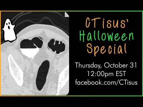 Facebook Live: CTisus' Halloween Special