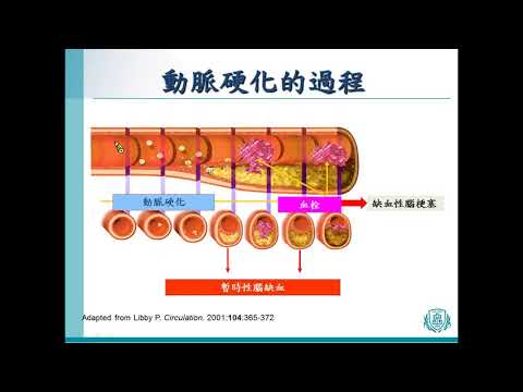 01 陳龍醫師 什麼是腦中風，腦中風會遺傳嗎