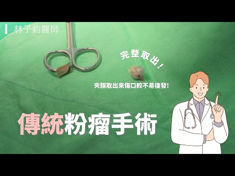 傳統粉瘤切除手術2 -極緻美型·文心極緻美型皮膚科診所整形手術-林子鈞醫師：台中粉瘤_粉瘤手術_微創粉瘤_粉瘤健保