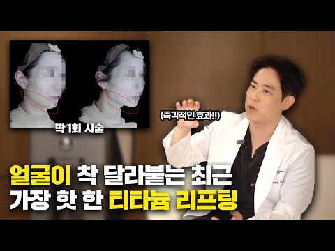 1회 시술 받자마자 착! 달라붙는 레이저 리프팅, 티타늄 리프팅을 소개합니다